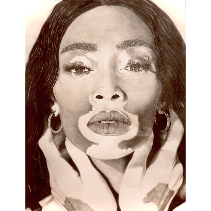 Vitiligo (Model Winnie Harlow) - Mixed technique, pure graphic pencil-graphite by Romano Davide - Fp Art Online